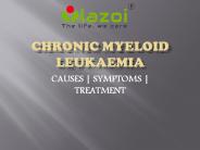 Chronic myelogenous leukemia: causes, symptoms and treatment