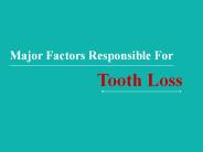 Major Factors Responsible For Tooth Loss