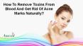 How To Remove Toxins From Blood And Get Rid Of Acne Marks Naturally? PowerPoint PPT Presentation