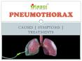 Pneumothorax : causes, symptoms, diagnosis and treatment PowerPoint PPT Presentation