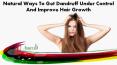 Natural Ways To Get Dandruff Under Control And Improve Hair Growth PowerPoint PPT Presentation