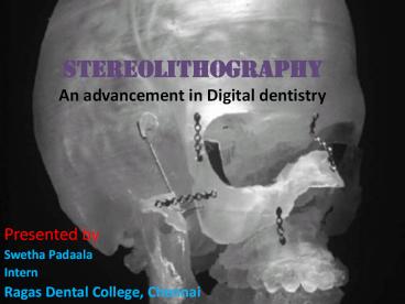 STEREOLITHOGRAPHY%20An%20advancement%20in%20Digital%20dentistry