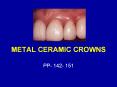 METAL CERAMIC CROWNS PowerPoint PPT Presentation