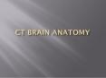 CT BRAIN anatomy PowerPoint PPT Presentation