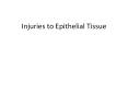 Injuries to Epithelial Tissue PowerPoint PPT Presentation