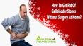 How To Get Rid Of Gallbladder Stones Without Surgery At Home? PowerPoint PPT Presentation