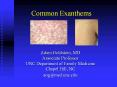 Common Exanthems PowerPoint PPT Presentation