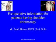 Pre-operative information for patients having shoulder arthroscopy