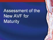 Assessment of the New AVF for Maturity