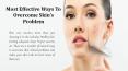 Most Effective Ways To Overcome Skin’s Problem PowerPoint PPT Presentation