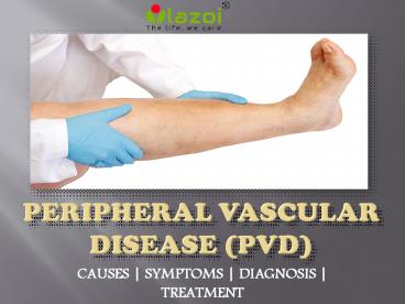 Peripheral Vascular Disease (PVD)