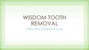 Wisdom teeth removal procedure