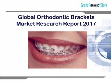 Global orthodontic brackets market research report 2017