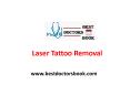 Laser Tattoo Removal in Hyderabad PowerPoint PPT Presentation