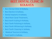 Dental Implants in kolkata (1)