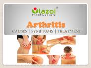 Arthritis : causes, symptoms, treatment and prevention