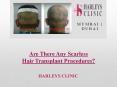 Are There Any Scarless Hair Transplant Procedures? PowerPoint PPT Presentation