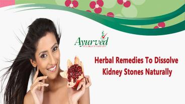 Herbal Remedies To Dissolve Kidney Stones Naturally