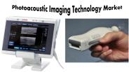 Photoacoustic Imaging Technology Market