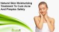 Natural Skin Moisturizing Treatment To Cure Acne And Pimples Safely PowerPoint PPT Presentation