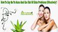 How To Say No To Acne And Get Rid Of Skin Problems Effectively? PowerPoint PPT Presentation