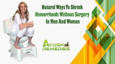 Natural Ways To Shrink Hemorrhoids Without Surgery In Men And Women