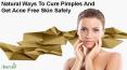 Natural Ways To Cure Pimples And Get Acne Free Skin Safely PowerPoint PPT Presentation