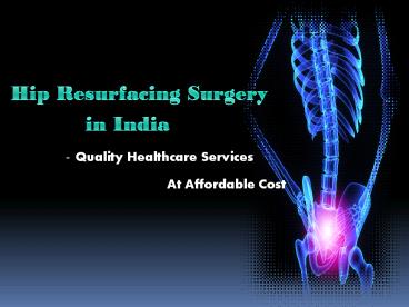 Hip Resurfacing Surgery in India