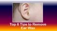 Top 6 Tips to Remove Ear Wax PowerPoint PPT Presentation
