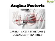 Angina pectoris : causes, symptoms, diagnosis and treatment