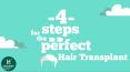 4 Steps For The Perfect Hair Transplant PowerPoint PPT Presentation