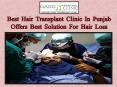 Best  Hair  Transplant  Clinic  In  Punjab Offers  Best  Solution  For  Hair  Loss PowerPoint PPT Presentation