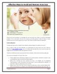 Effective Ways to Avoid and Remove Acne Scar PowerPoint PPT Presentation