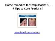 Home remedies for scalp psoriasis –7 Tips to Cure Psoriasis !