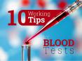 10 Working Tips for Blood Test PowerPoint PPT Presentation