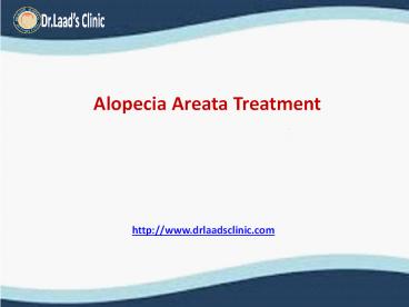 Alopecia-areata-treatment