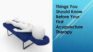 Things to do before your first Acupuncture Therapy