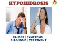 Hypohidrosis: Causes, sign, symptoms, diagnosis and treatment