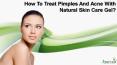 How To Treat Pimples And Acne With Natural Skin Care Gel? PowerPoint PPT Presentation