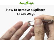 Four Ways to Remove A Splinter
