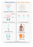Difference between gama knife and cyber knife surgery PowerPoint PPT Presentation