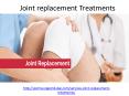 Who is giving best Joint replacement Treatments in Dubai PowerPoint PPT Presentation