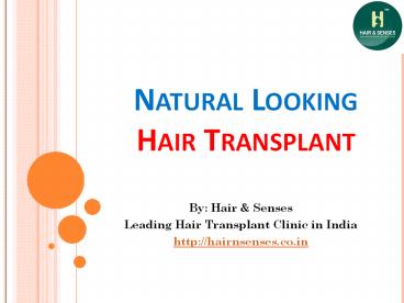 Natural Looking Hair Transplant