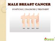 Male Breast Cancer : Symptoms, diagnosis and treatment
