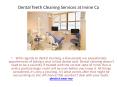 Dental Teeth Cleaning Services at Irvine Ca PowerPoint PPT Presentation