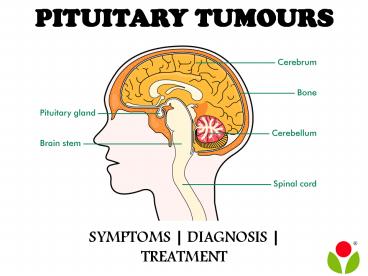 Pituitary tumours : symptoms, diagnosis and treatment