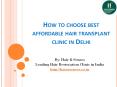 How to Choose Best Affordable Hair Transplant Clinic In Delhi PowerPoint PPT Presentation
