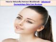How To Naturally Remove Blackheads-Advanced Dermatology Skin Care Reviews PowerPoint PPT Presentation