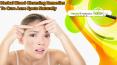 Herbal Blood Cleansing Remedies To Cure Acne Spots Naturally
