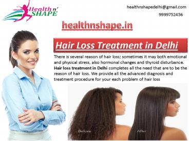 Hair Loss Treatment in Delhi